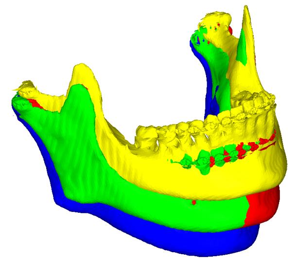 3D-JAW